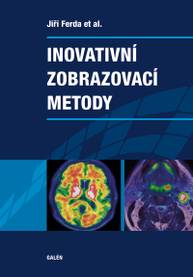 E-kniha Inovativní zobrazovací metody - Jiří Ferda, at al.