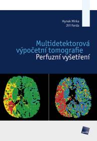 E-kniha Multidetektorová výpočetní tomografie - Jiří Ferda, Hynek Mírka