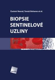 E-kniha Biopsie sentinelové uzliny - Čestmír Neoral, Tomáš Bohanes