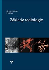 E-kniha Základy radiologie - Jiří Heřman, kolektiv a