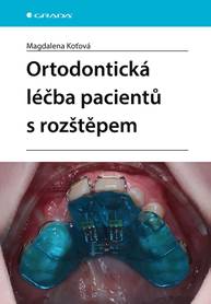 E-kniha Ortodontická léčba pacientů s rozštěpem - Magdalena Koťová