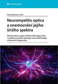 E-kniha Neuromyelitis optica a poruchy jejího širšího spektra - kolektiv a, Petra Nytrová