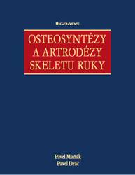 E-kniha Osteosyntézy a artrodézy skeletu ruky - Pavel Dráč, Pavel Maňák