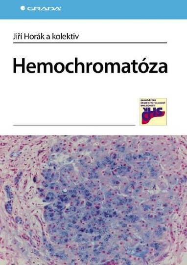 E-kniha Hemochromatóza - Jiří Horák, kolektiv a