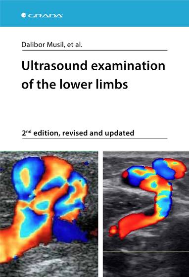 E-kniha Ultrasound examination of the lower limbs - Dalibor et al. Musil