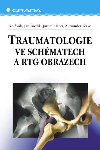 E-kniha Traumatologie ve schématech a RTG obrazech - Alexander Ferko, Ivo Žvák, Jan Brožík, Jaromír Kočí