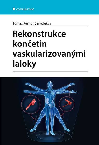 E-kniha Rekonstrukce končetin vaskularizovanými laloky - kolektiv a, Tomáš Kempný