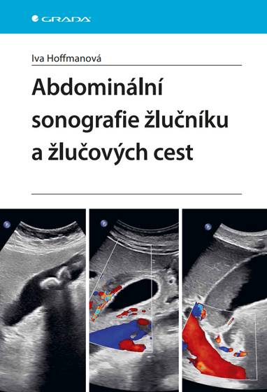 E-kniha Abdominální sonografie žlučníku a žlučových cest - Iva Hoffmanová