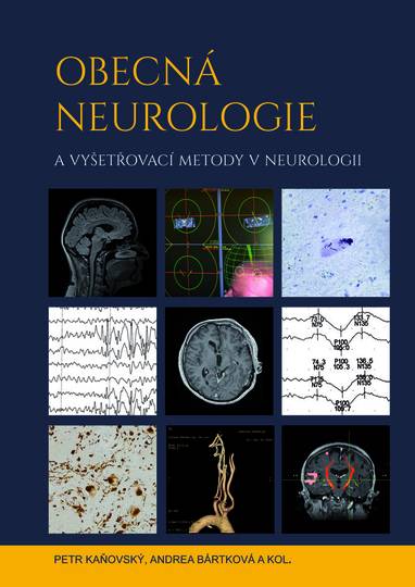 E-kniha Obecná neurologie a vyšetřovací metody v neurologii - kolektiv a, Andrea Bártková, Petr Kaňovský