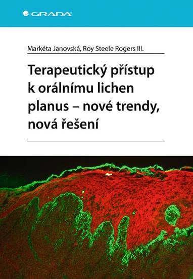 E-kniha Terapeutický přístup k orálnímu lichen planus - nové trendy, nová řešení - Markéta Janovská, Rogers III. Roy Steele