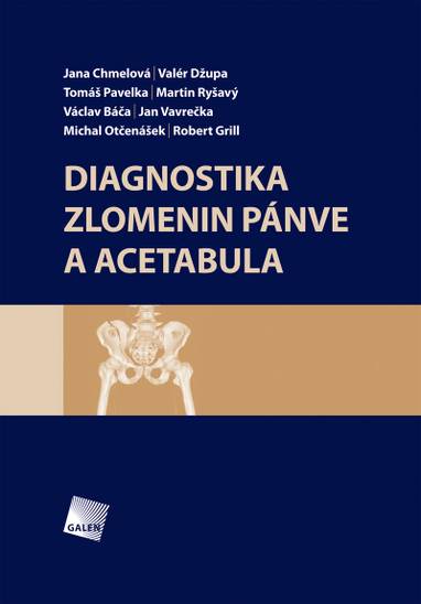 E-kniha Diagnostika zlomenin pánve a acetabula - Tomáš Pavelka, Jan Vavrečka, Jana Chmelová, Valér Džupa, Václav Báča